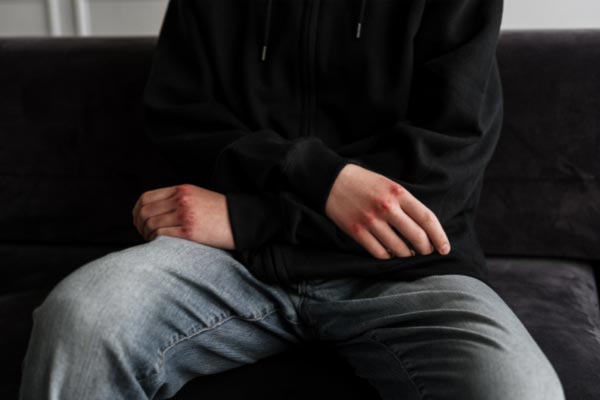 Researchers Conclude Non-suicidal Self-harm is Similar to Addiction